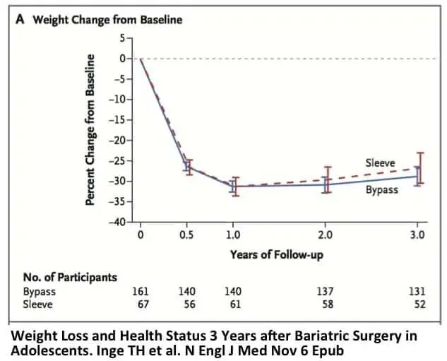 Chirurgie bariatrique ou jeûne intermittent ? Quelle méthode est la plus efficace pour maigrir ?